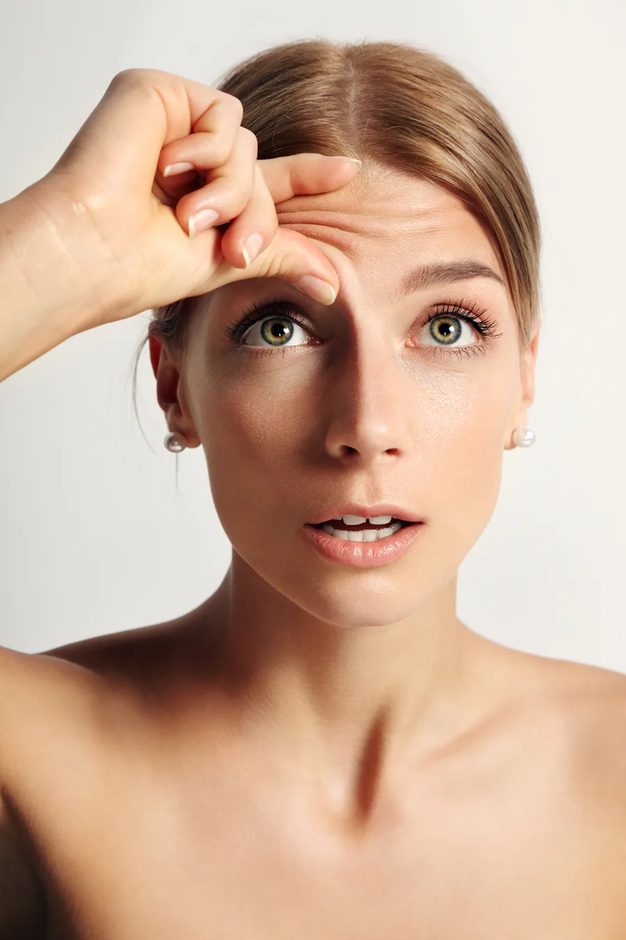 Forehead lines Botox® treatment