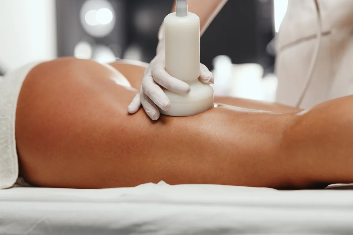 Non-surgical butt lift with Sculptra®, Radiesse® and Venus Bliss MAX™ at Kenzi MedSpa in Naples