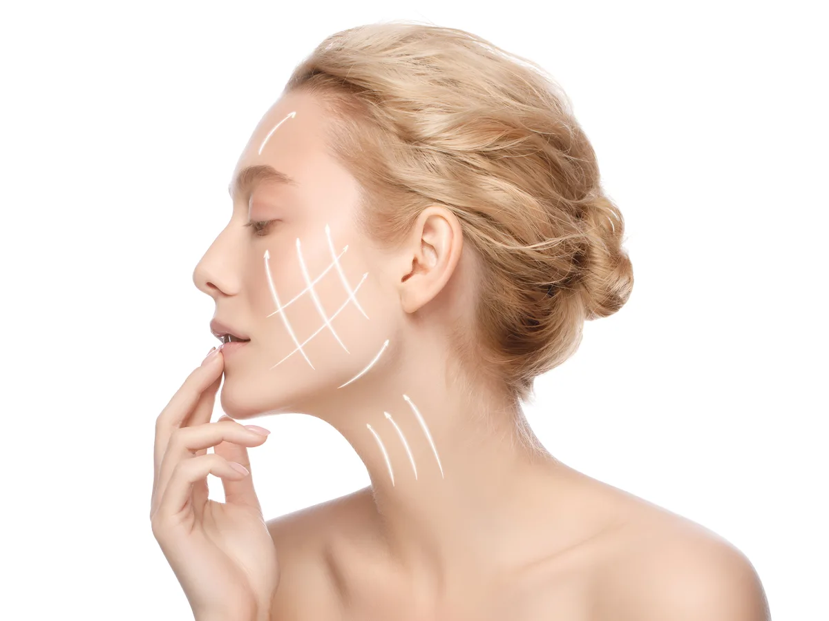 PDO Thread Lift face and neck treatment at Kenzi MedSpa in Naples