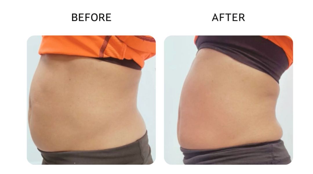 venus bliss max before and after2